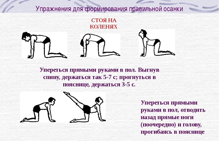 Простые упражнения для правильной осанки