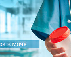 Общий анализ мочи: признаки и причины повышенного белка, норма белка в моче. Анализ мочи по Нечипоренко: для чего проводится, как правильно собирать мочу? Повышенный белок в моче: лечение и профилактика