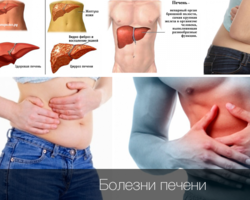 Печень: функции органа и признаки нарушения его работы, народные средства для лечения печени, диета. Профилактика недугов печени