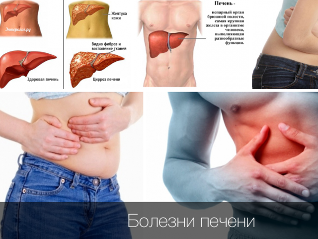 Печень: функции органа и признаки нарушения его работы, народные средства для лечения печени, диета. Профилактика недугов печени