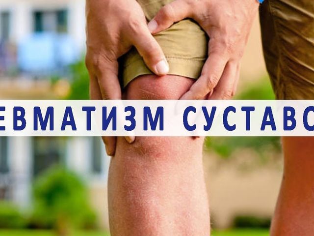 Ревматизм суставов: причины, симптомы и лечение. Как и чем лечат ревматизм суставов: препараты, народные методы
