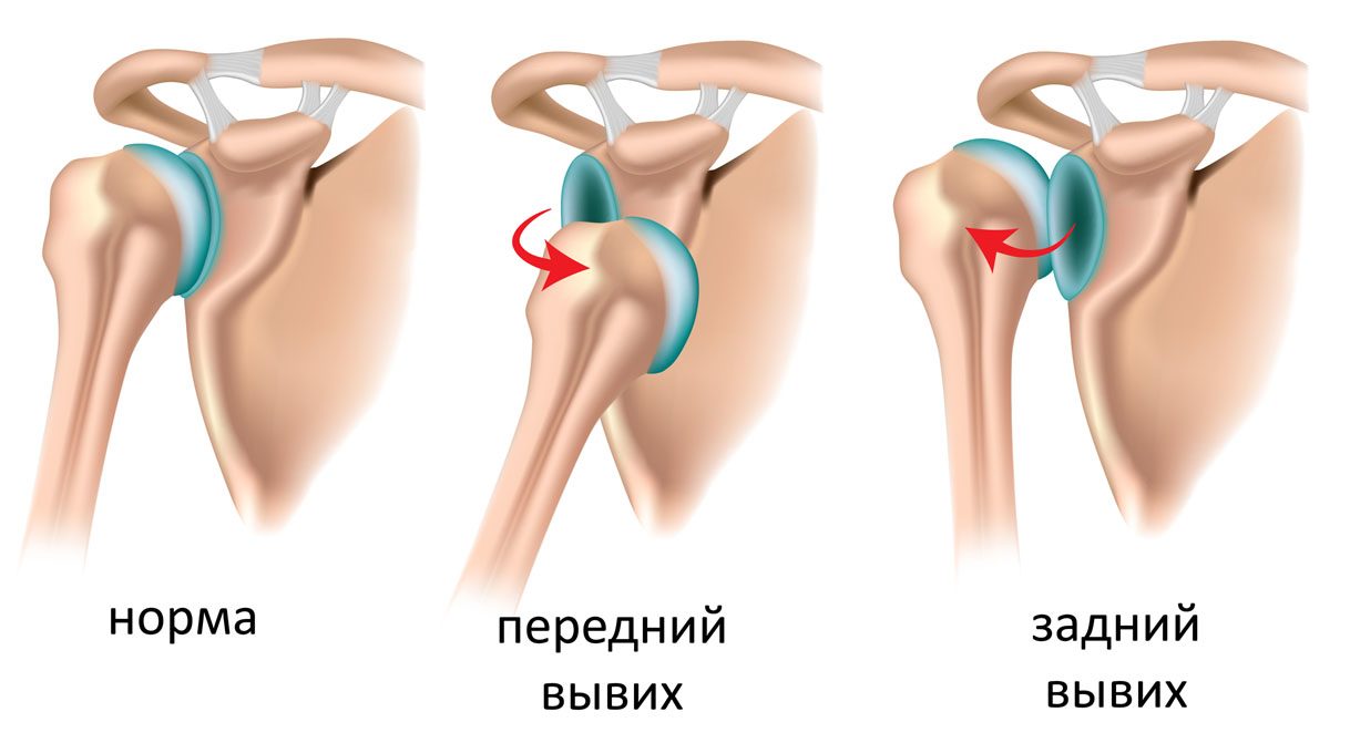 Виды