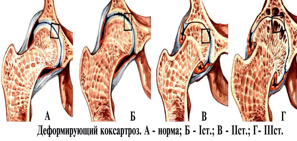 3 степени