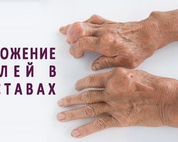 Почему соли откладываются в суставах — медикаментозное лечение, спасение с помощью народной медицины: выведение лишних солей из суставов