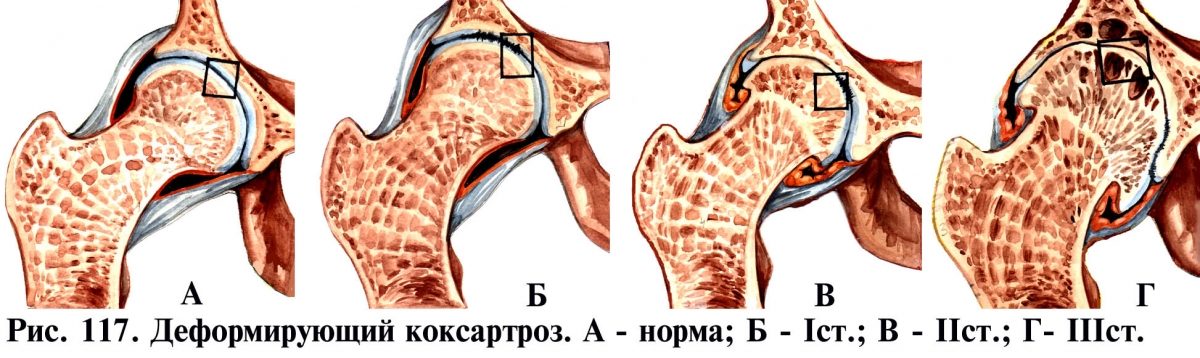 Степени
