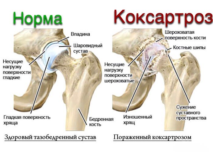 Диагностировать вовремя очень важно