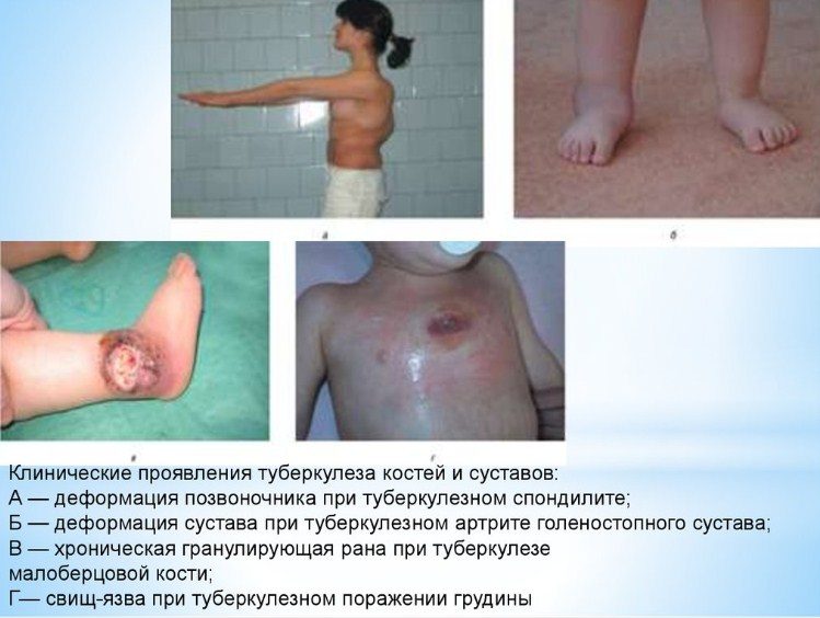 Заболевание