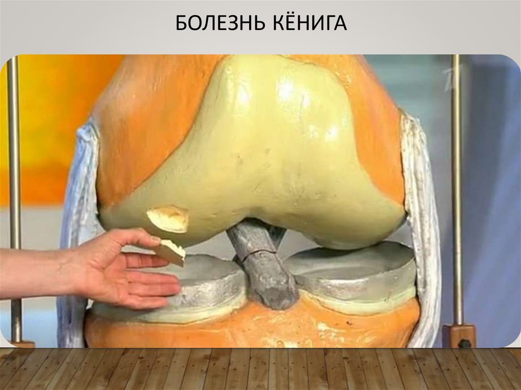 Проявление
