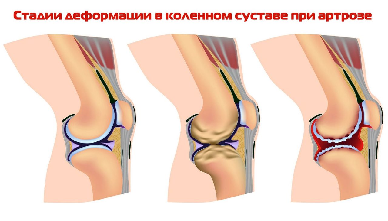 Стадии