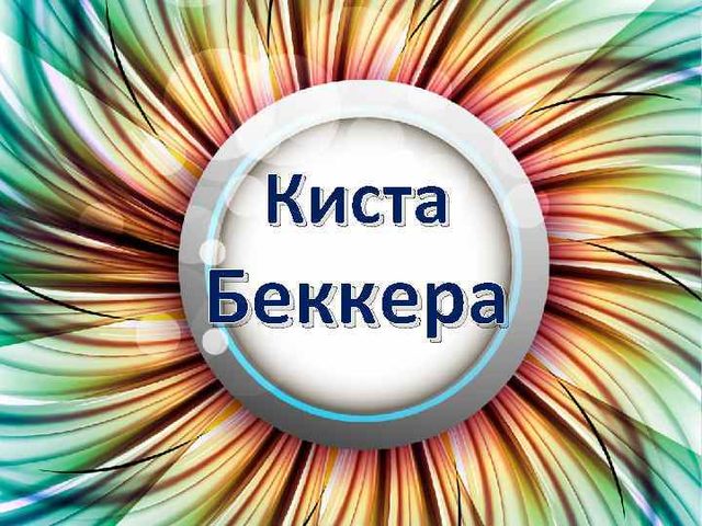 Киста Беккера коленного сустава: причины появления, симптомы, диагностика, лечение медикаментозное и народными методами, профилактика, упражнения