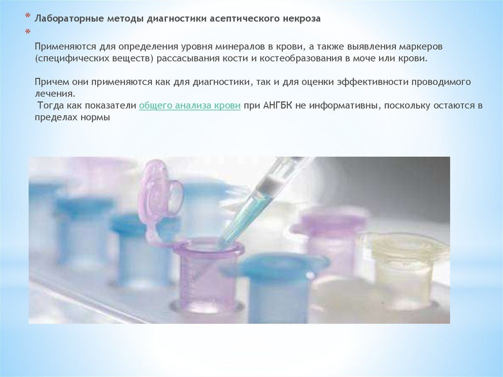 Анализы