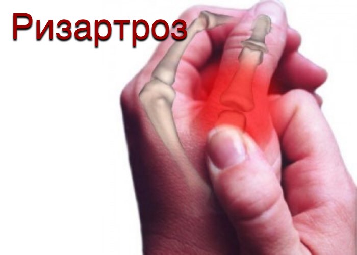Деформация