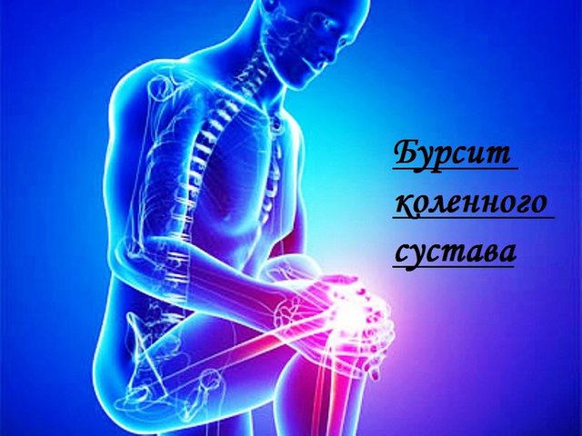 Почему появляется бурсит? Разновидности бурсита. Основные методы лечения бурсита в официальной медицине. Народные средства для борьбы с бурситом