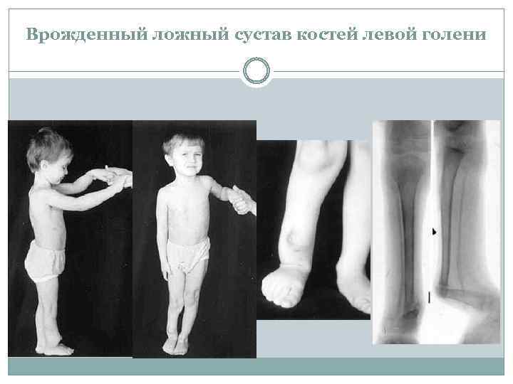 С рождения