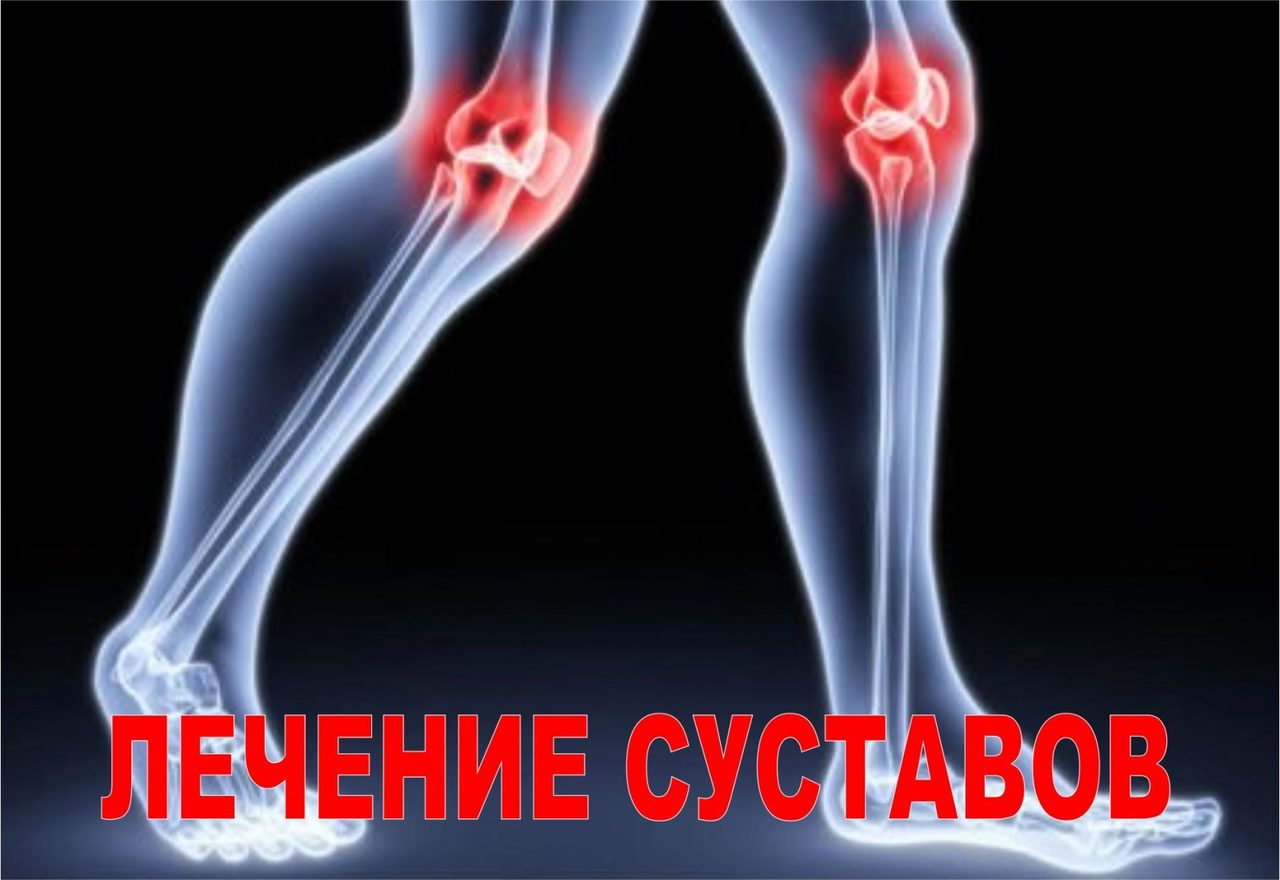 Как лечить суставы?