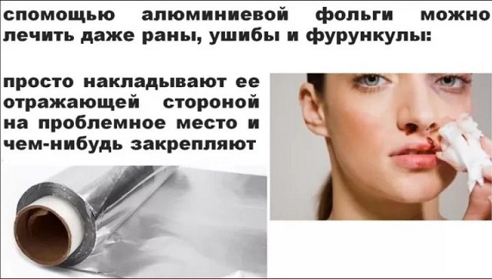 Что можно лечить фольгой