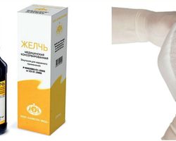 Медицинская желчь при артрозе коленного сустава. Свойства медицинской желчи, при каких патологиях показана желчь? Медицинская желчь при артрозе коленного сустава: как делать компрессы, отзывы о препарате