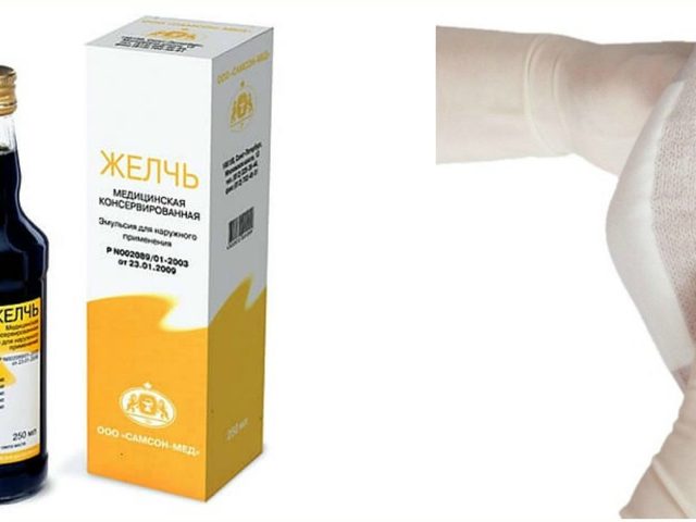 Медицинская желчь при артрозе коленного сустава. Свойства медицинской желчи, при каких патологиях показана желчь? Медицинская желчь при артрозе коленного сустава: как делать компрессы, отзывы о препарате