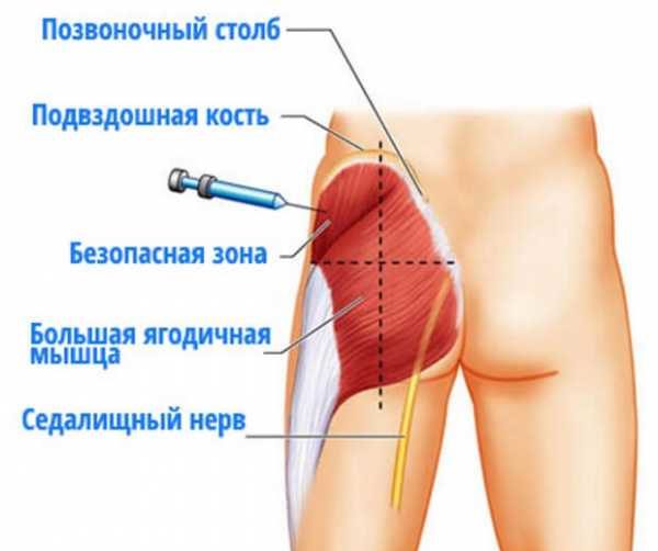Выбор места для укола