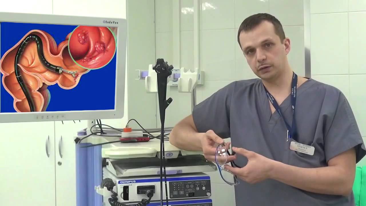 Колоноскоп