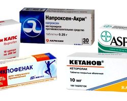 Обезболивающие таблетки и мази при болях в спине и суставах ненаркотические и наркотические, анальгетики, хондропротекторы, обезболивающие, согревающие и противовоспалительные: название, список, показания, как правильно использовать?
