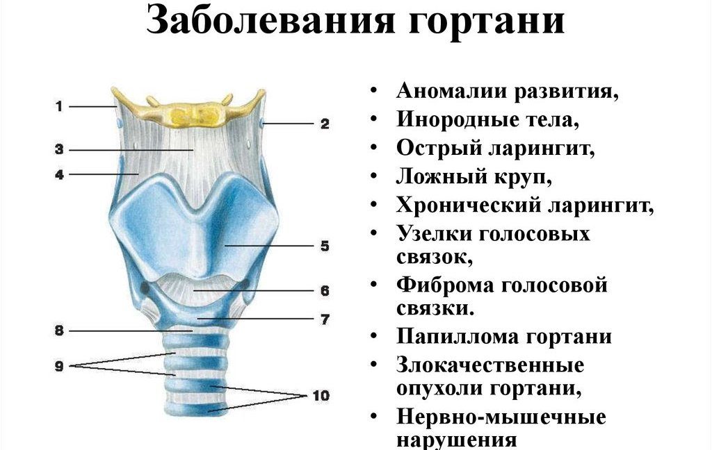 Заболевания гортани
