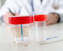 Оксалаты в моче: что это значит? Причины появления оксалатов в моче у ребенка и взрослого. Как избавиться от оксалатов в моче?