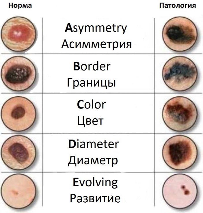 Параметры диагностики