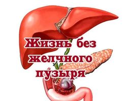 Жизнь после удаления желчного пузыря: важные советы, плюсы и минусы, диета, запрещенные и разрешенные продукты
