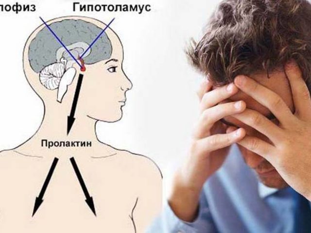 За что отвечает пролактин у мужчин: основные факторы, влияющие на концентрацию, симптомы и последствия повышения, допустимые параметры — как снизить уровень пролактина у мужчин?