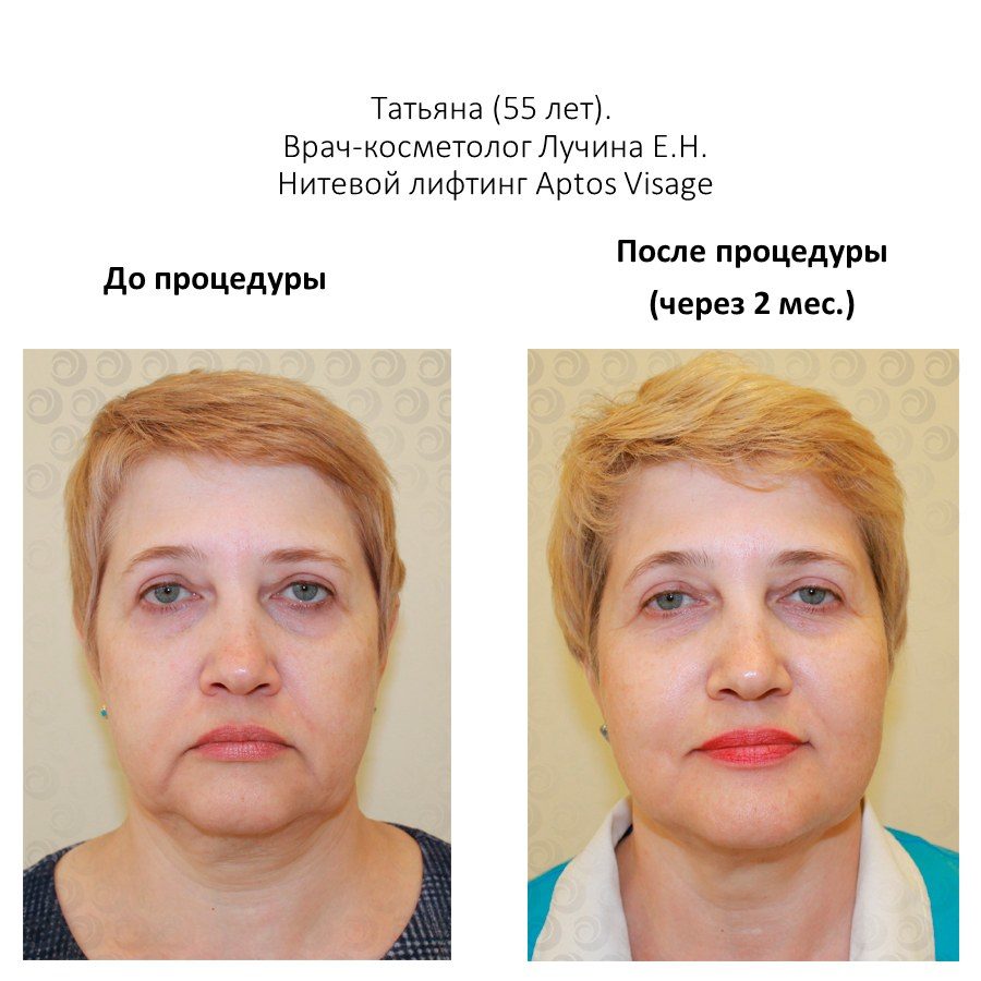 После 50