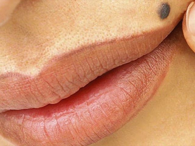 Родинки на теле — что означают: поверья, приметы. Как понять, что означает родинка на теле у женщины, мужчины? 