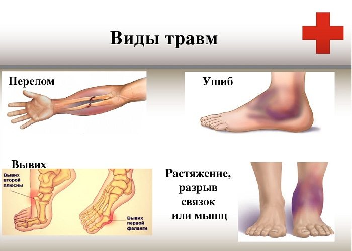 Основные виды