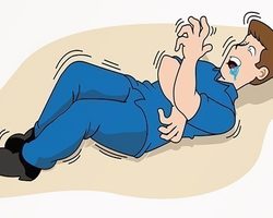 Эпилепсия: описание заболевания, симптомы, причины, диагностика, факторы риска, профилактика, жизнь с эпилепсией, отзывы, лечение с помощью медикаментов, лечебной физкультуры, диеты, хирургическим методом. Что такое эпилептический приступ, эпилептичекий статус, как помочь человеку? Можно ли вылечить эпилепсию, передается ли она по наследству?