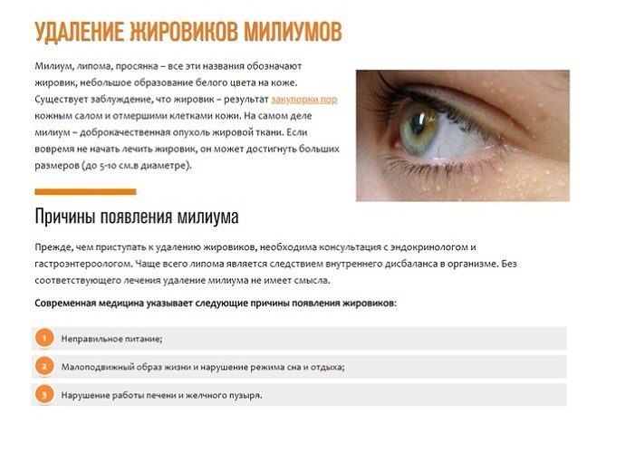 Причины