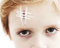 Ребенок постоянно сдирает корочку от раны: причины — что делать?