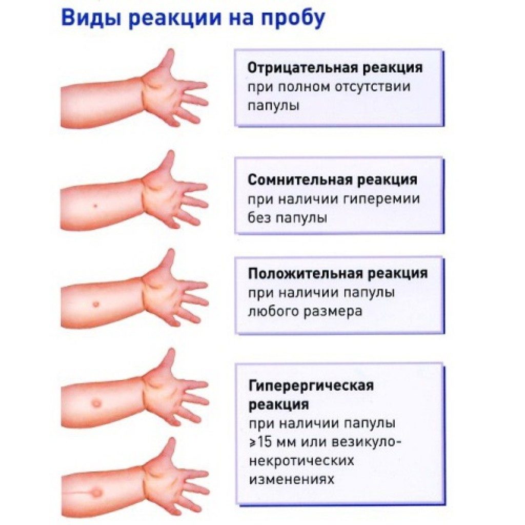 Реакция может усилиться из-за внешних факторов