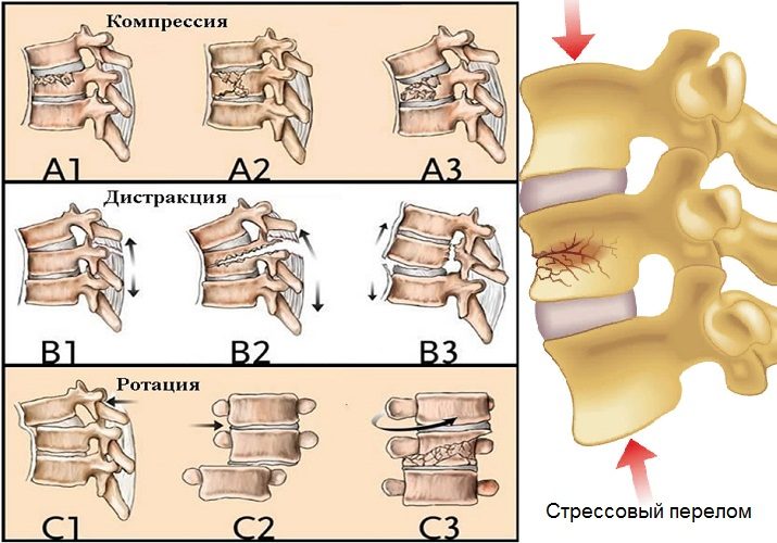 Классификация