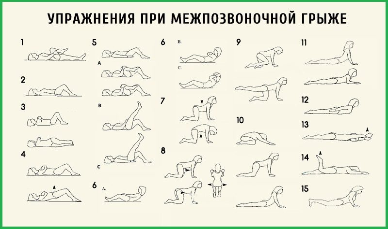 Разнообразие при грыже