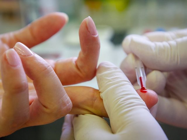 Как определить анемию самостоятельно без анализов: тест. Какой анализ нужно сдать на анемию?