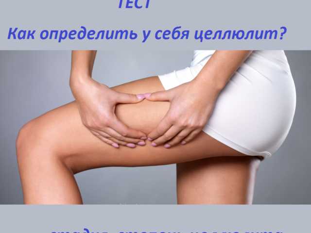 Как определить — есть ли у тебя целлюлит самостоятельно: тест, стадии целлюлита, фото