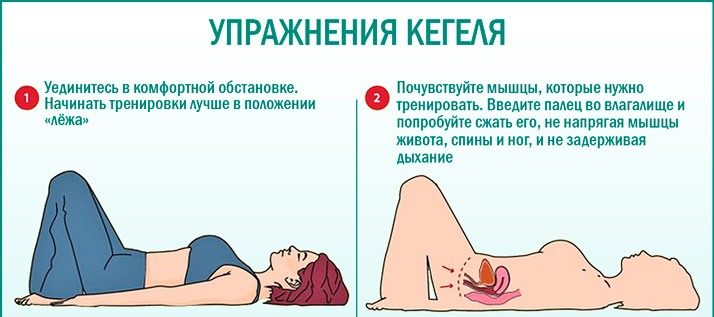 Недержание мочи у женщин: лечение при помощи упражнений кегеля