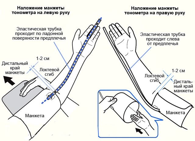 На какой руке?