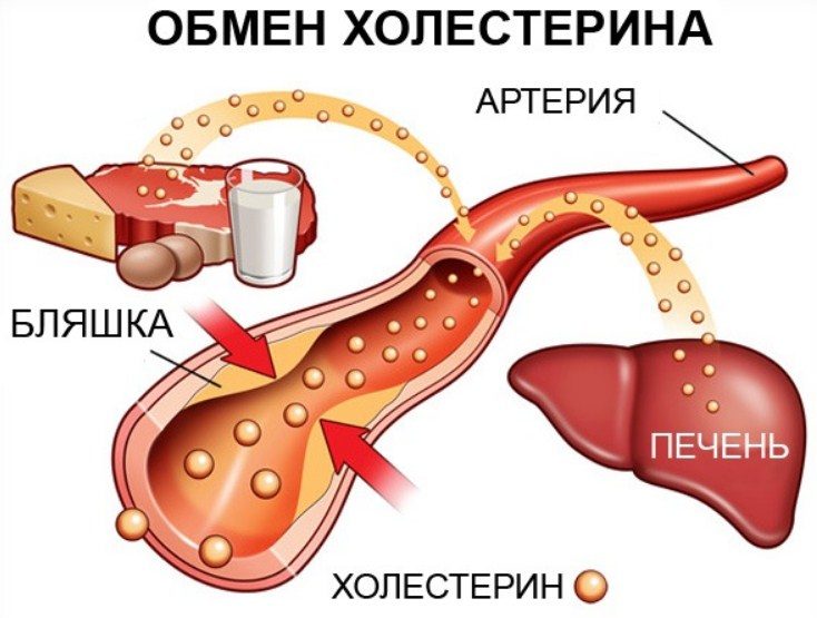 От бляшек