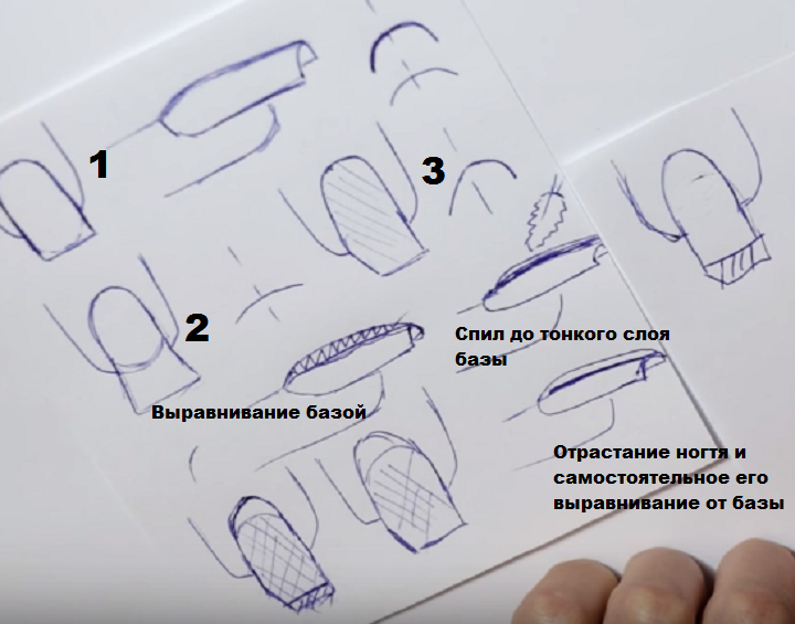 1 - равные ногти, 2 - по форме трапеции, 3 - скрученные с оной стороны