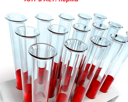 Норма АСТ и АЛТ в крови у женщин, мужчин, детей, при беременности