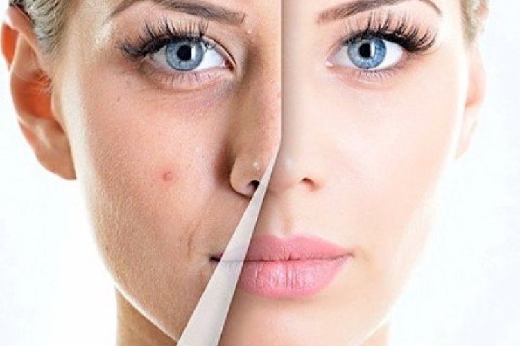 Пересмотрите отношение