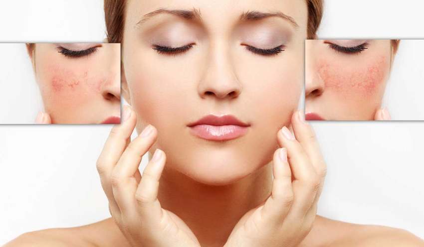 От неприятия себя