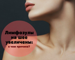 Увеличены лимфоузлы на шее, воспаленный лимфоузел на шее: признаки, причины, лечение, отзывы