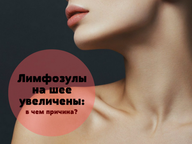 Увеличены лимфоузлы на шее, воспаленный лимфоузел на шее: признаки, причины, лечение, отзывы